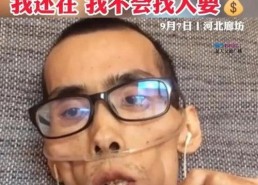 最近最恶心的网红,揭秘其背后真相与争议